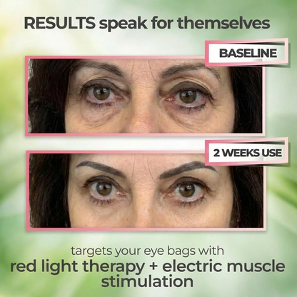 FeelTouchHeal™ Anti Eyebags Glasses