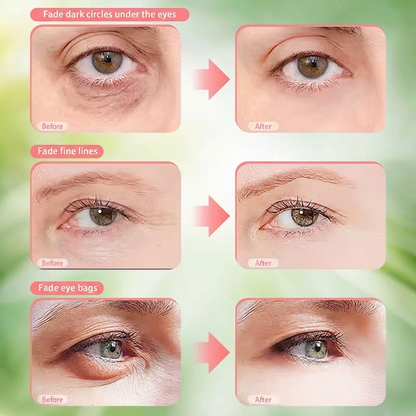 FeelTouchHeal™ Anti Eyebags Glasses
